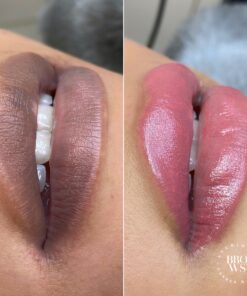 Lips Neutralization